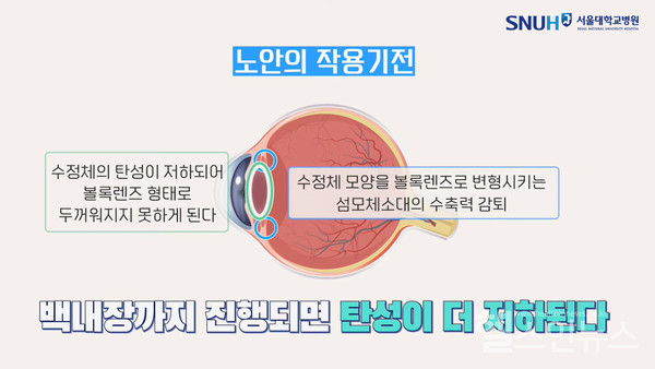 노안작용기전