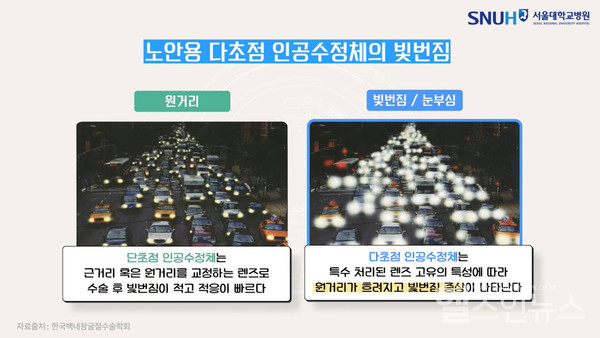 노안용다초점렌즈특징