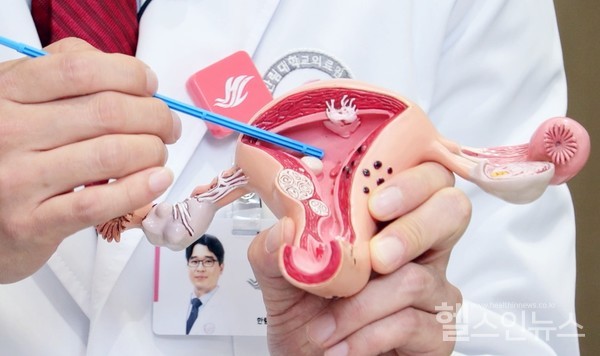 한림대강남성심병원박성택산부인과교수가자궁모형을가리키며설명하고있다.(출처=유튜브‘씩씩TV’)
