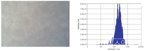 피부섬유아세포및분리된엑소좀의특성화