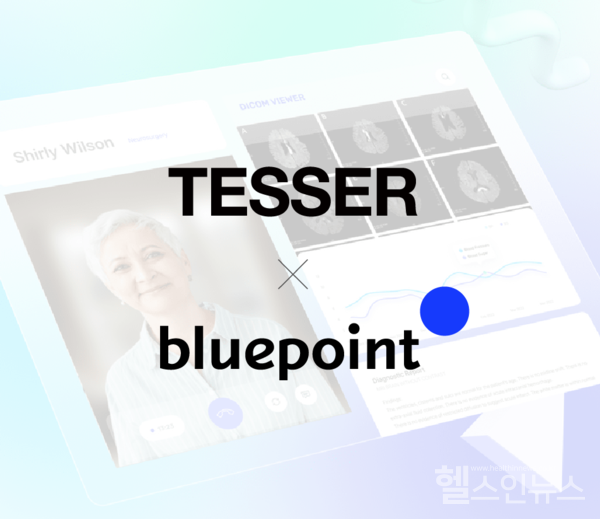 테서,블루포인트