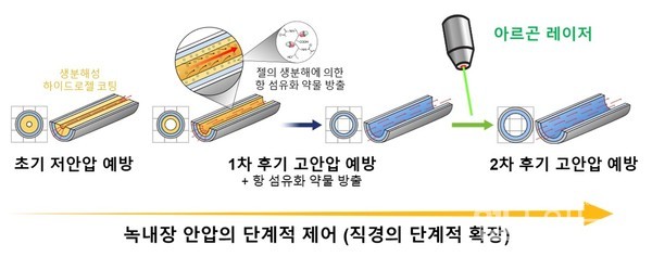 연구팀개발방수튜브의녹내장병기에따른안압조절원리