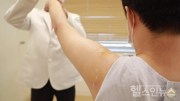 자생한방병원의료진이견관절장애환자에게동작침법을시행하고있다.