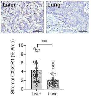 유방암환자의간전이조직(왼쪽)의미세환경세포에서폐전이조직(오른쪽)보다높은CX3CR1의발현을보여줌