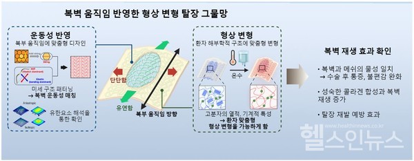 연구팀이새로개발한탈장수술메쉬(세브란스제공)