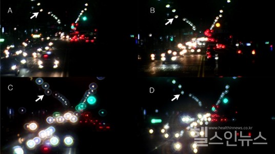 휴대용모델눈으로촬영한야간도로.A:단초점인공수정체,B:향상된기능의단초점인공수정체,C:다초점인공수정체,D:연속초점인공수정체
