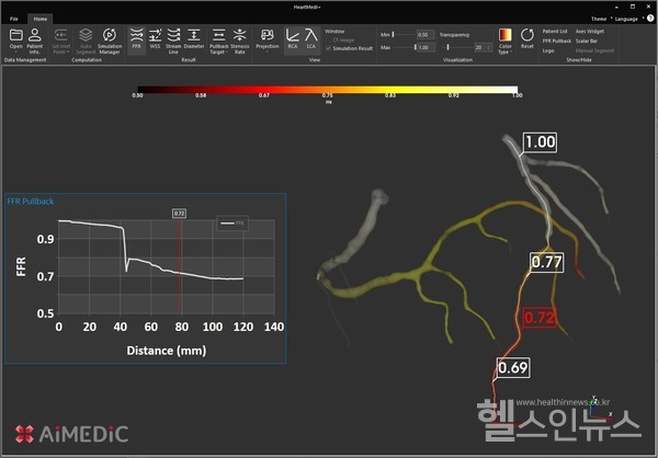 에이아이메딕제공