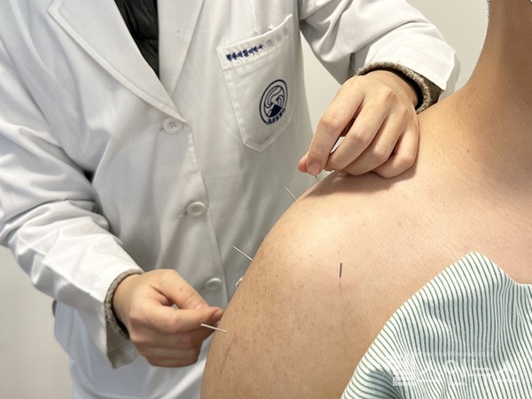 자생한방병원의료진이회전근개파열환자의어깨에침치료를실시하고있다.