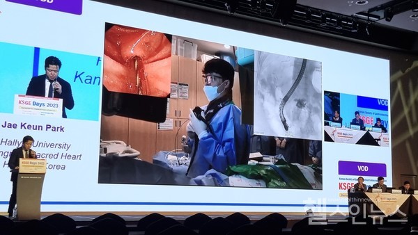 한림대강남성심병원소화기내과박재근교수가9일열린‘KSGEDays2023’에서거대담도석제거술시연영상을보며발표하고있다.