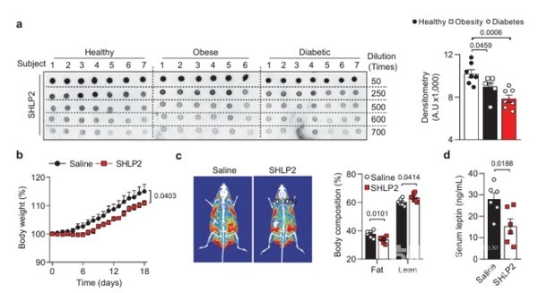 연세대학교치과대학구강생물학교실김기우교수,김슬기학생연구팀논문중일부