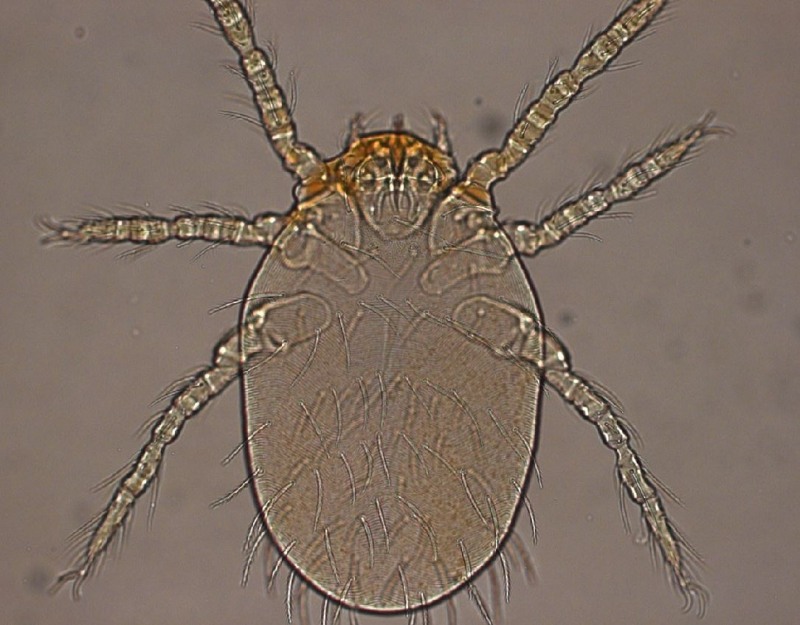 활순털진드기 / 사진=광주광역시 제공