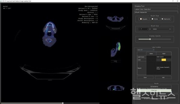 케이메디허브제공