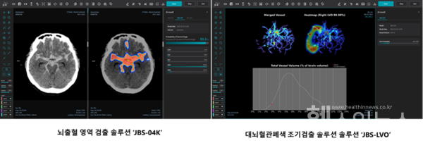 제이엘케이제공