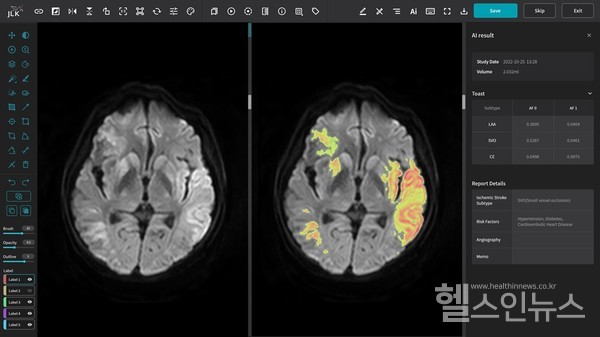 제이엘케이제공