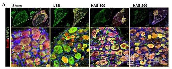 신경세포의실험군별통증수용체(TRPV1)발현모습.하르파고사이드투여군에서초록색으로염색된TRPV1이감소한것을확인할수있다