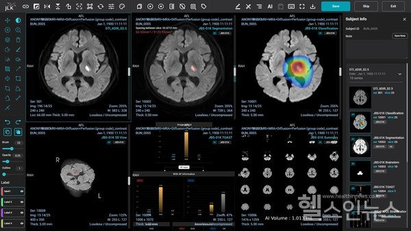 제이엘케이제공