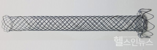 문종호교수팀에서개발한내시경초음파유도하간위루술전용금속배액관(SPAXUS-MGstent)