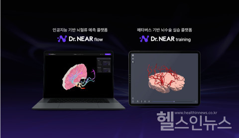 니어브레인제공
