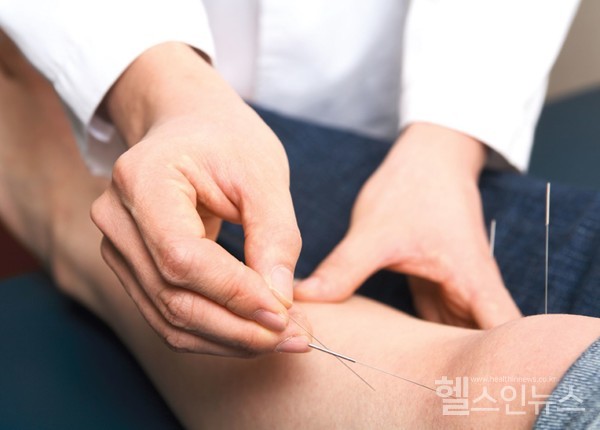 자생한방병원의료진이침치료를시행하고있다.