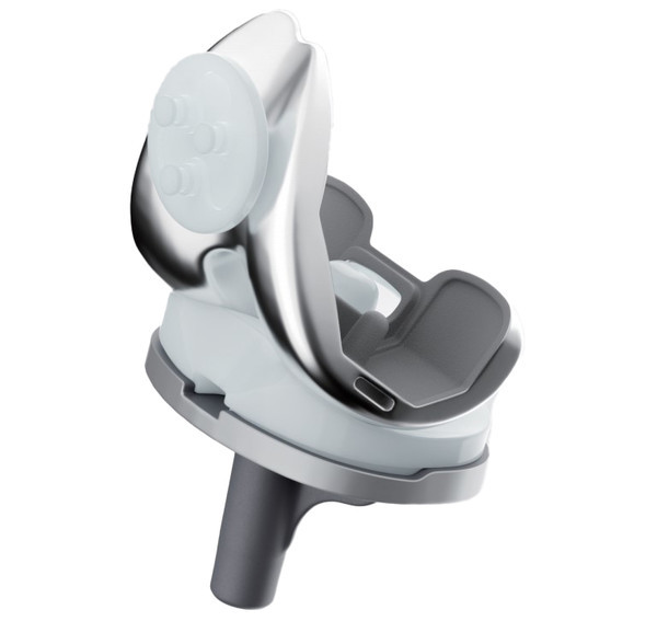 한국인맞춤형PNK인공관절