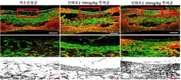 붉은색으로표시된척수손상부위에서신바로2투여군의세포축삭성장을확인할수있다