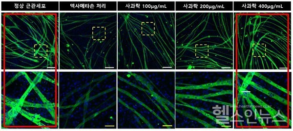 사과락농도가높을수록근관세포의크기와수가정상에가깝게회복되는모습