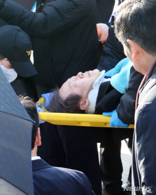 이재명 더불어민주당 대표가 2일 오전 부산 강서구 대항전망대를 방문해 가덕신공항 건설 예정지를 둘러본 뒤 흉기 피습을 당해 이송되고 있다. (사진 = 뉴시스)