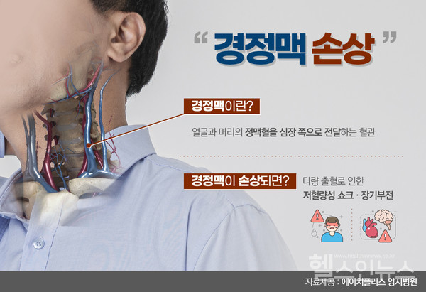 경정맥손상응급처치(출처:에이치플러스양지병원)