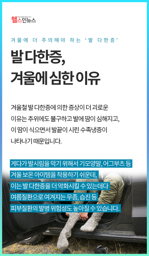 겨울철 다한증으로 인한 땀분비를 감소시키는 치료법 3