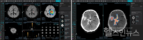 제이엘케이제공