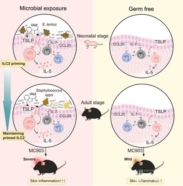생후초기피부에I3A를생성하는포도상구균이노출되면,각질세포에서TSLP의분비가증가돼제2형선천성림프구의활성이유도된다.이와같은생후초기의제2형선천성림프구의활성은성인기에알레르기성피부염증을촉진하는데영향을미치게된다.