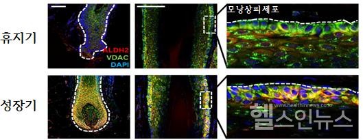휴지기모낭과성장기모낭에서ALDH2발현비교.면역염색분석결과,주로모낭의가장바깥쪽층(모낭상피세포층)에서성장기에ALDH2가뚜렷하게나타났다.