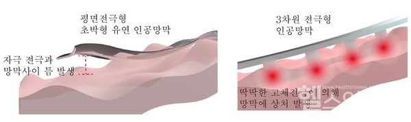 기존고체금속기반의평면전극형/3차원전극형인공망막의한계.