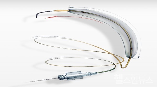 식약처가희소·긴급도입필요의료기기신규지정한'정맥용혈관폐색용카테터'(4등급)