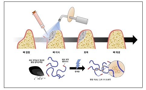 가시광선을이용하여수술현장에서바로가교가능한접착성단백질하이드로젤을뼈이식재접착제로활용하는모식도