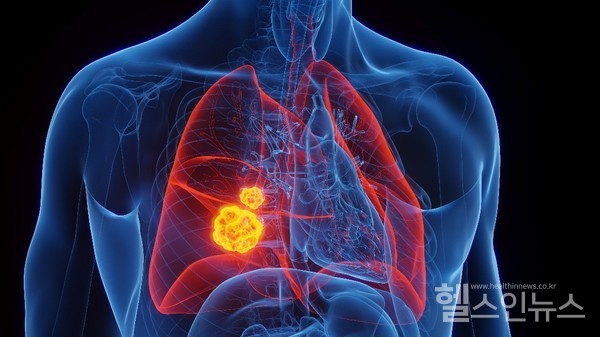 GC녹십자의료재단제공