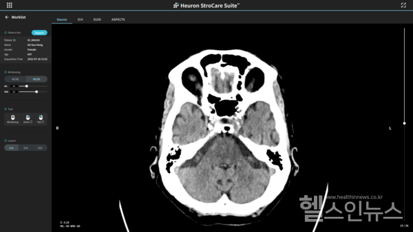 휴런,‘HeuronStroCareSuite’의구동모습