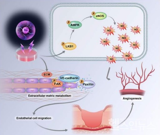 액상바이오플라즈마가혈관신생을촉진해손상된혈관치료하는기전의도식도