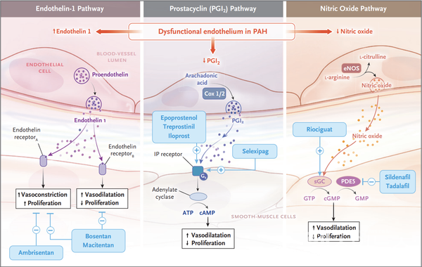 출처:NEnglJMed.2021;385(25):2361-2376