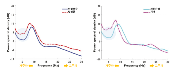 신경퇴행성질환발병여부(왼쪽)및신경퇴행성질환유형(오른쪽)에따른뇌파비교