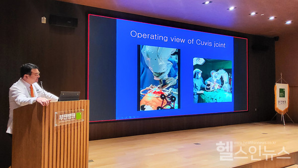 로봇인공관절수술케이스를설명하는서울부민병원하용찬병원장