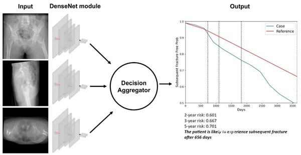 연구팀개발딥러닝모델의구조도.고관절의정면,측면,횡단면방사선사진을분석하고이를조합해산출한재골절위험자유도를생존곡선으로형태로표현함.환자의생존곡선(파란선)이기준값곡선(빨간선)보다낮아지는시점을재골절발생시점으로예측할수있다.