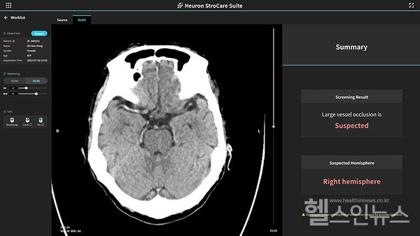 휴런,HeuronStroCareSuite™구동모습