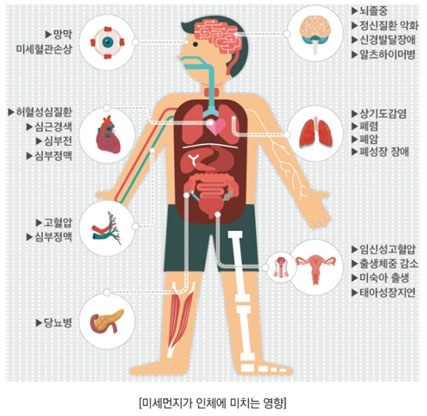 출처 : 질병관리본부