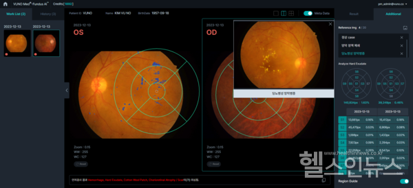 뷰노메드펀더스AI™운영화면예시