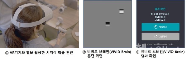 디지털치료기기‘비비드브레인(VIVIDBrain)’주요화면