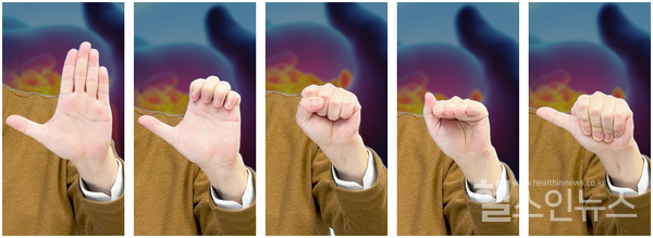 신경활주운동자세별사진