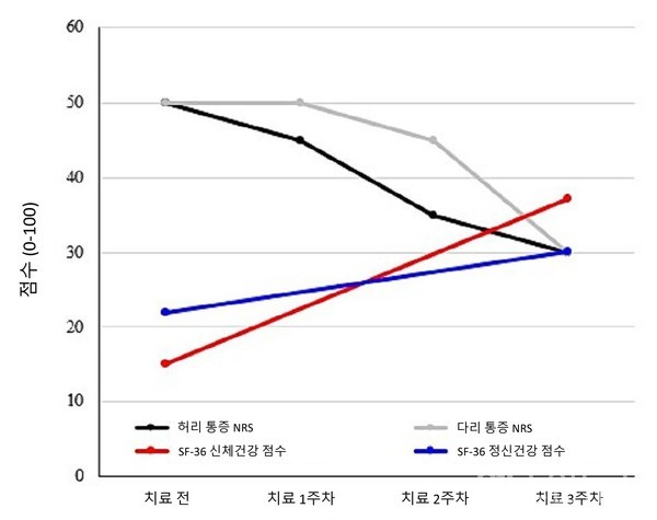 동작침법과단계적운동요법을실시한결과척추수술실패증후군환자의NRS는감소하고SF-36건강설문점수가상승한것으로나타났다