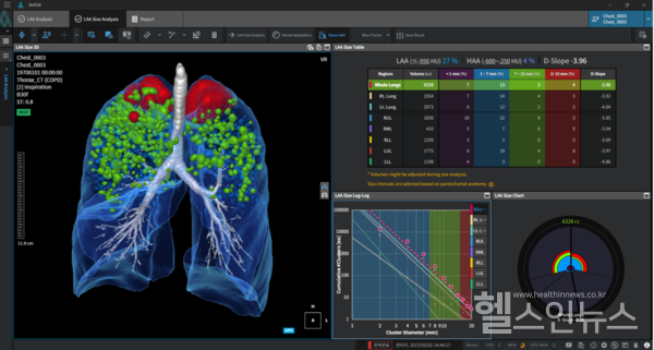 AVIEWCOPD