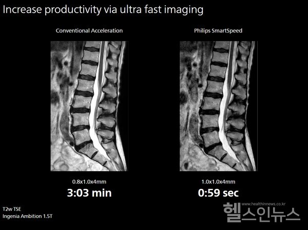 MRI영상품질및스캔시간비교–기존영상(좌)와SmartSpeed적용후영상(우)